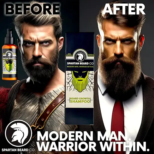 𝗦𝗣𝗔𝗥𝗧𝗔𝗡 𝗕𝗘𝗔𝗥𝗗™ Dầu gội (Giảm 80% - Đơn hàng đầu tiên)
